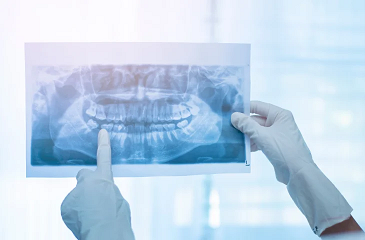 SES auxilia na compra de raio-X panorâmico para equipar municípios com estrutura odontológica avançada