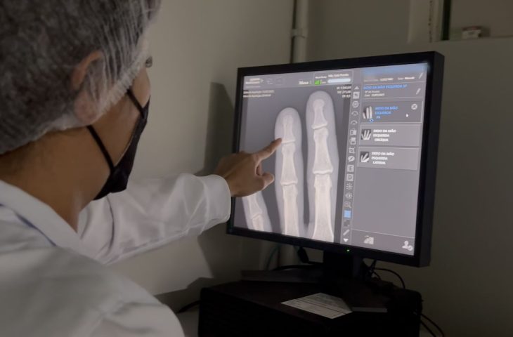 Governo entrega ultrassom e raio-x de alta resolução que ampliam precisão em mais de 600 exames por mês