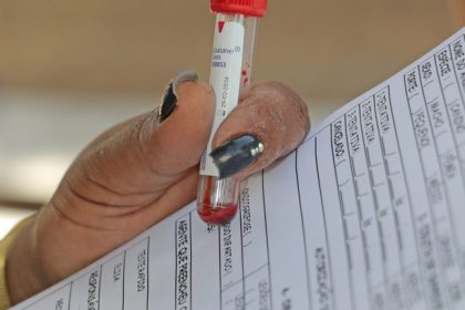 Prefeitura de Três Lagoas realiza Dia D de Prevenção e Combate à Leishmaniose Visceral nesta sexta-feira (22)