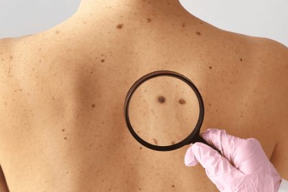 SMS proporciona mutirão dermatológico em alusão a campanha “Dezembro Laranja”