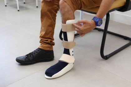 Saúde orienta população sobre como solicitar órteses e próteses pelo SUS em Três Lagoas